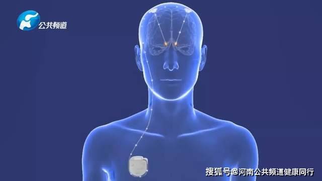 梅杰癥最新治療方法研究與應(yīng)用進展